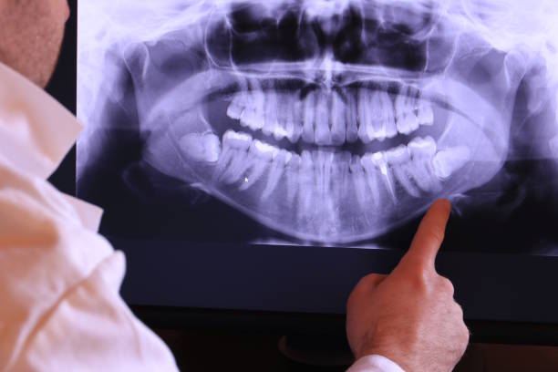 Best Emergency Treatment for Oral Infections in Osseo, MN